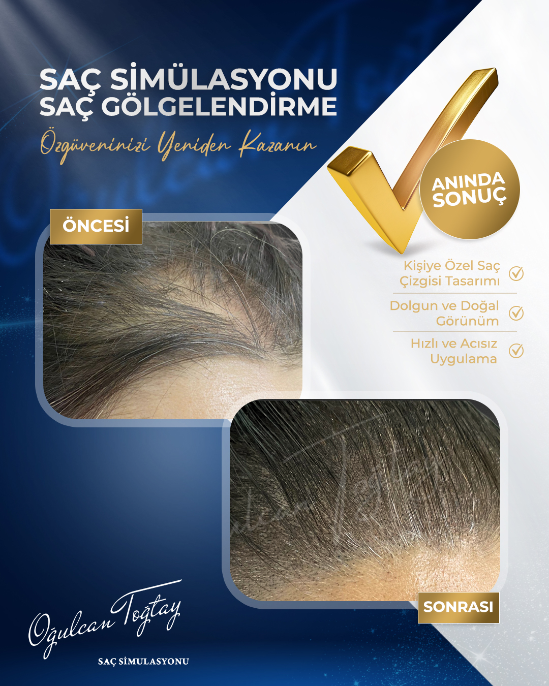 OĞULCAN TOĞTAY _6 BEFORE AFTER REV